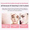 New ultrasonic peeling machine multifunctional facial blackhead peeling instrument into cleansing instrument pore cleaning instrument-Pink - default