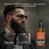 Beard Oil For MEN Hair Growth Oil Serum Mustache Grooming Growing Moisturizer US - Hair Growth Oil Serum - Beard Oil